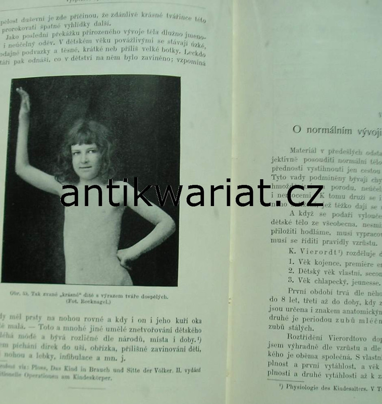 1wa Image00501
