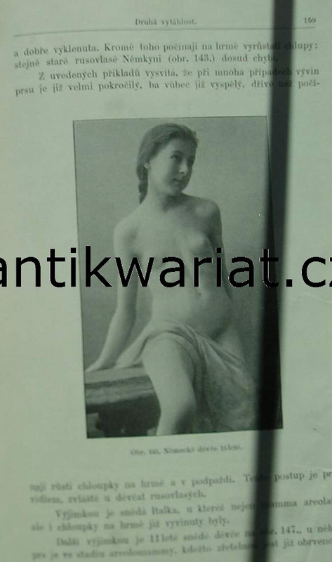 1wa Image00476