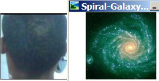 Top of head spiral galaxy