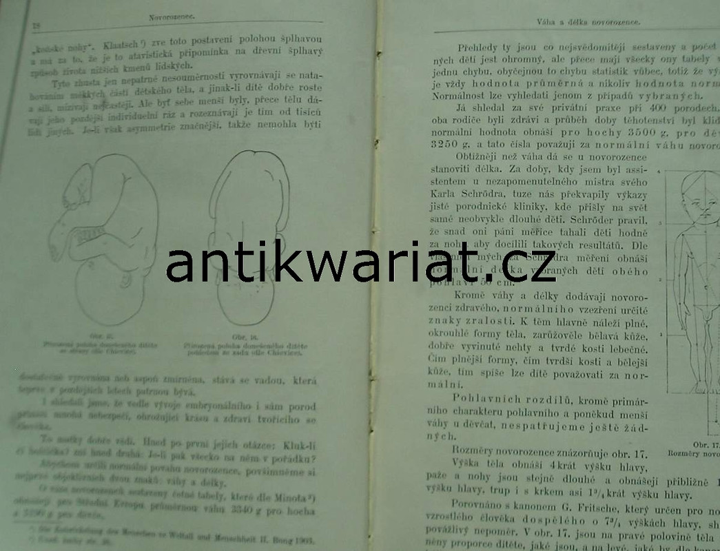 1wa Image00514