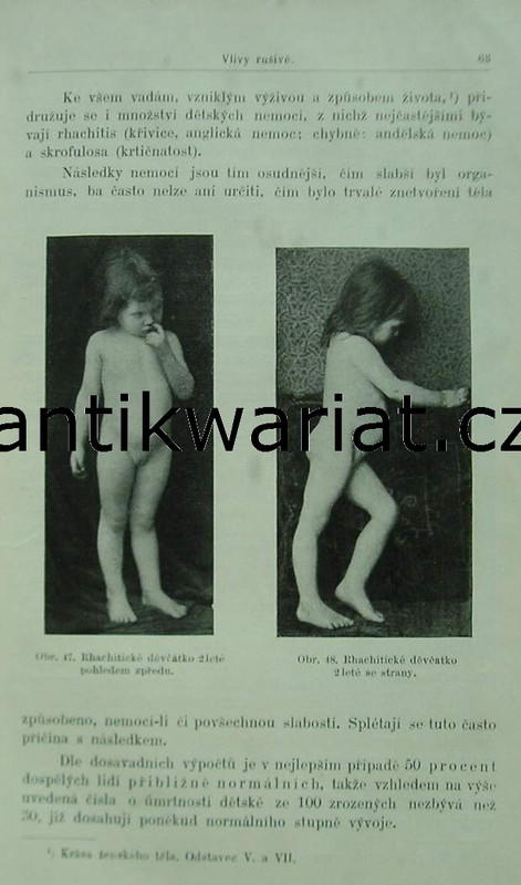 1wa Image00503